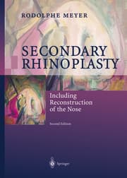 Cover von Secondary Rhinoplasty