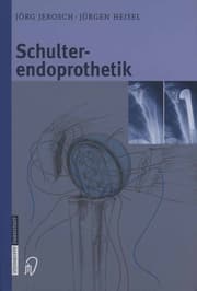 Cover von Schulterendoprothetik