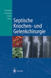 Cover von Septische Knochen-und Gelenkchirurgie