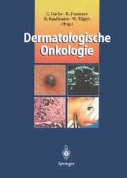 Cover von Dermatologische Onkologie