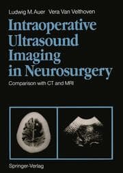 Cover von Intraoperative Ultrasound Imaging in Neurosurgery