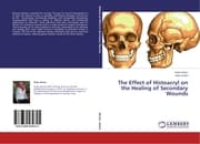Cover von The Effect of Histoacryl on the Healing of Secondary Wounds