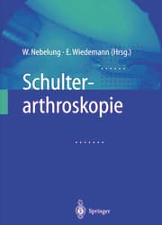 Cover von Schulterarthroskopie