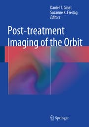 Cover von Post-treatment Imaging of the Orbit