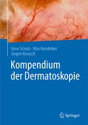 Cover von Kompendium der Dermatoskopie
