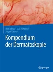 Cover von Kompendium der Dermatoskopie