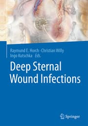 Cover von Deep Sternal Wound Infections