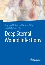 Cover von Deep Sternal Wound Infections