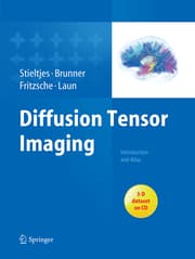 Cover von Diffusion Tensor Imaging