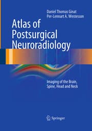 Cover von Atlas of Postsurgical Neuroradiology