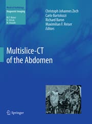 Cover von Multislice-CT of the Abdomen
