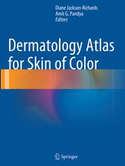 Cover von Dermatology Atlas for Skin of Color