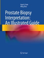 Cover von Prostate Biopsy Interpretation: An Illustrated Guide