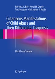 Cover von Cutaneous Manifestations of Child Abuse and Their Differential Diagnosis
