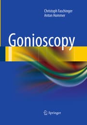 Cover von Gonioscopy