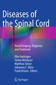 Cover von Diseases of the Spinal Cord