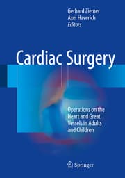 Cover von Cardiac Surgery