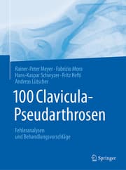 Cover von 100 Clavicula-Pseudarthrosen