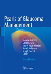 Cover von Pearls of Glaucoma Management