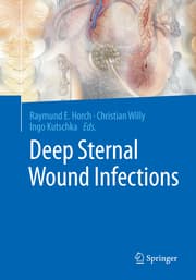 Cover von Deep Sternal Wound Infections
