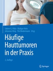 Cover von Häufige Hauttumoren in der Praxis