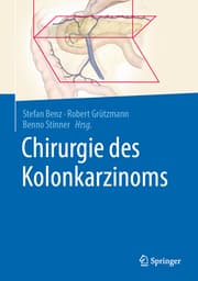 Cover von Chirurgie des Kolonkarzinoms