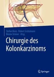 Cover von Chirurgie des Kolonkarzinoms
