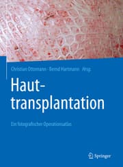 Cover von Hauttransplantation