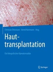 Cover von Hauttransplantation