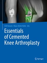 Cover von Essentials of Cemented Knee Arthroplasty