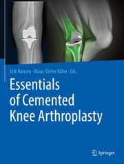 Cover von Essentials of Cemented Knee Arthroplasty