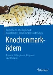 Cover von Knochenmarködem