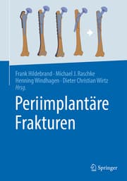 Cover von Periimplantäre Frakturen