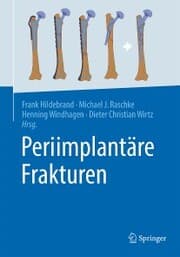 Cover von Periimplantäre Frakturen