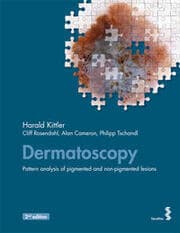 Cover von Dermatoscopy