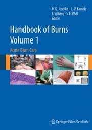 Cover von Handbook of Burns Volume 1