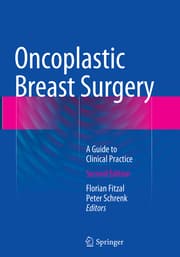 Cover von Oncoplastic Breast Surgery