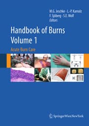 Cover von Handbook of Burns Volume 1