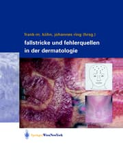 Cover von Fallstricke und Fehlerquellen in der Dermatologie