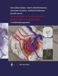 Cover von Neurosurgery of Arteriovenous Malformations and Fistulas