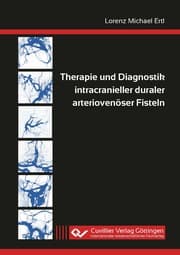 Cover von Therapie und Diagnostik intracranieller duraler arteriovenöser Fisteln