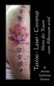 Cover von Tattoo - Laser - Cover Up