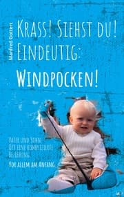 Cover von Krass! Siehst du! Eindeutig: Windpocken!