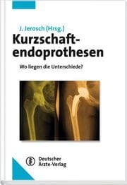 Cover von Kurzschaftendoprothesen