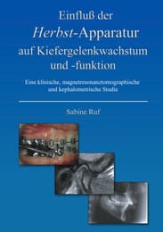 Cover von Einfluß der Herbst-Apparatur auf Kiefergelenkwachstum und -funktion