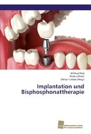Cover von Implantation und Bisphosphonattherapie