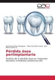 Cover von Pérdida ósea periimplantaria