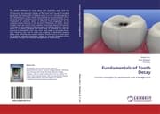 Cover von Fundamentals of Tooth Decay