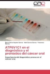Cover von ATP6V1C1 en el diagnóstico y el pronóstico del cáncer oral