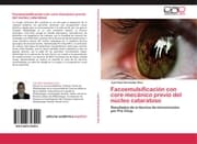 Cover von Facoemulsificación con core mecánico previo del núcleo cataratoso